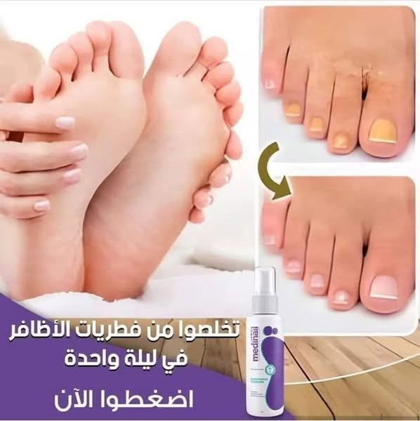 الحل النهائي لفطريات الأظافر - Spray Medinail