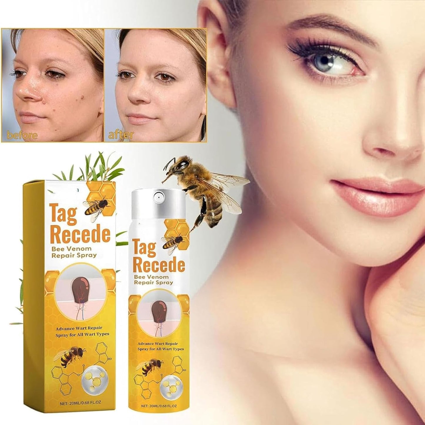 بخاخ إزالة الزوائد الجلدية بسمّ النحل – نتيجة سريعة وآمنة